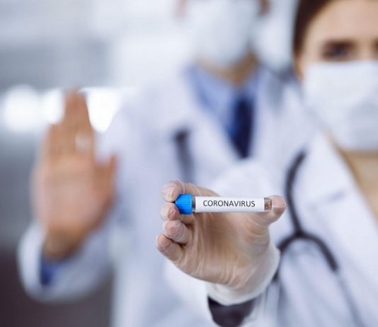 Još 24 osobe pozitivne na korona virus