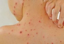 Šuga u srednjoj školi